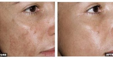 Fraxel - это неинвазивная лазерная процедура, которая обновляет кожу, возвращает ей молодость, свежесть и здоровье, устраняет пигментацию, выравнивает текстуру и цвет кожи, делает кожу более плотной и упругой.