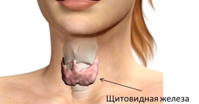 Щитовидную железу можно назвать главным «щитом» нашего организма. Так, с её помощью, происходит улучшение всех иммунных процессов в организме