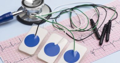 ЭКГ в МЦ"Клиника Южная" – это один из наиболее эффективных и доступных методов исследования состояния сердца.